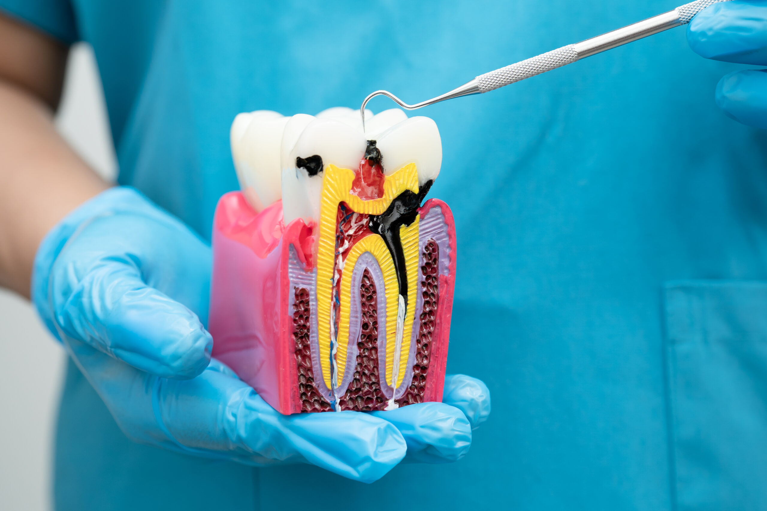 Pain Management and Comfort During Root Canal Treatment